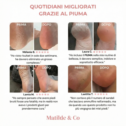 PIUMA - Levigatore Piedi Matilde & Co