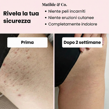 Matilde & Co. Epilatore a luce pulsata