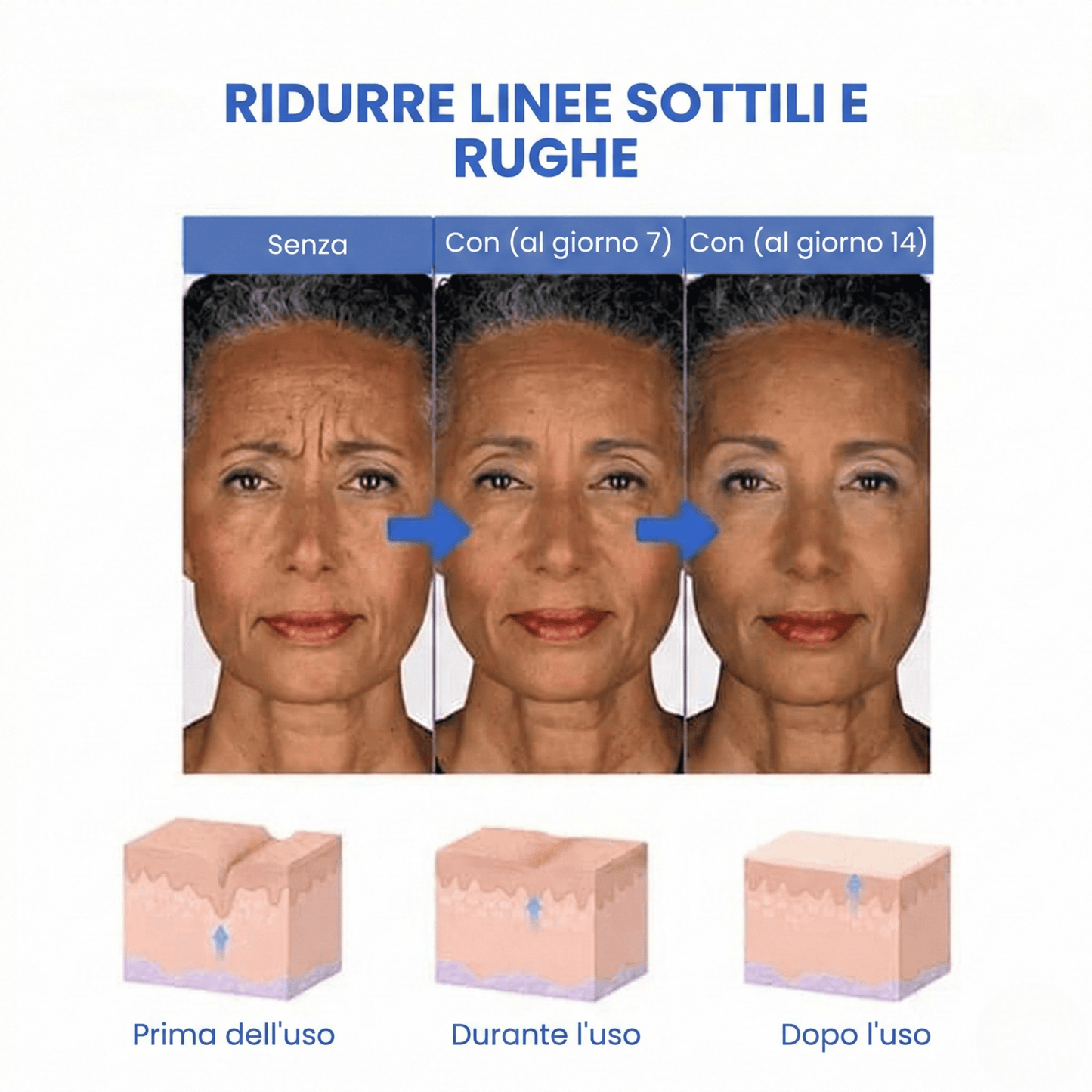 SkinLift™ | Siero Viso Botox