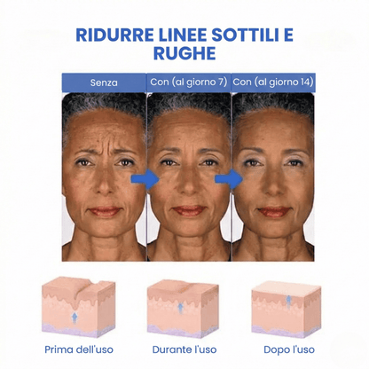 SkinLift™ | Siero Viso Botox