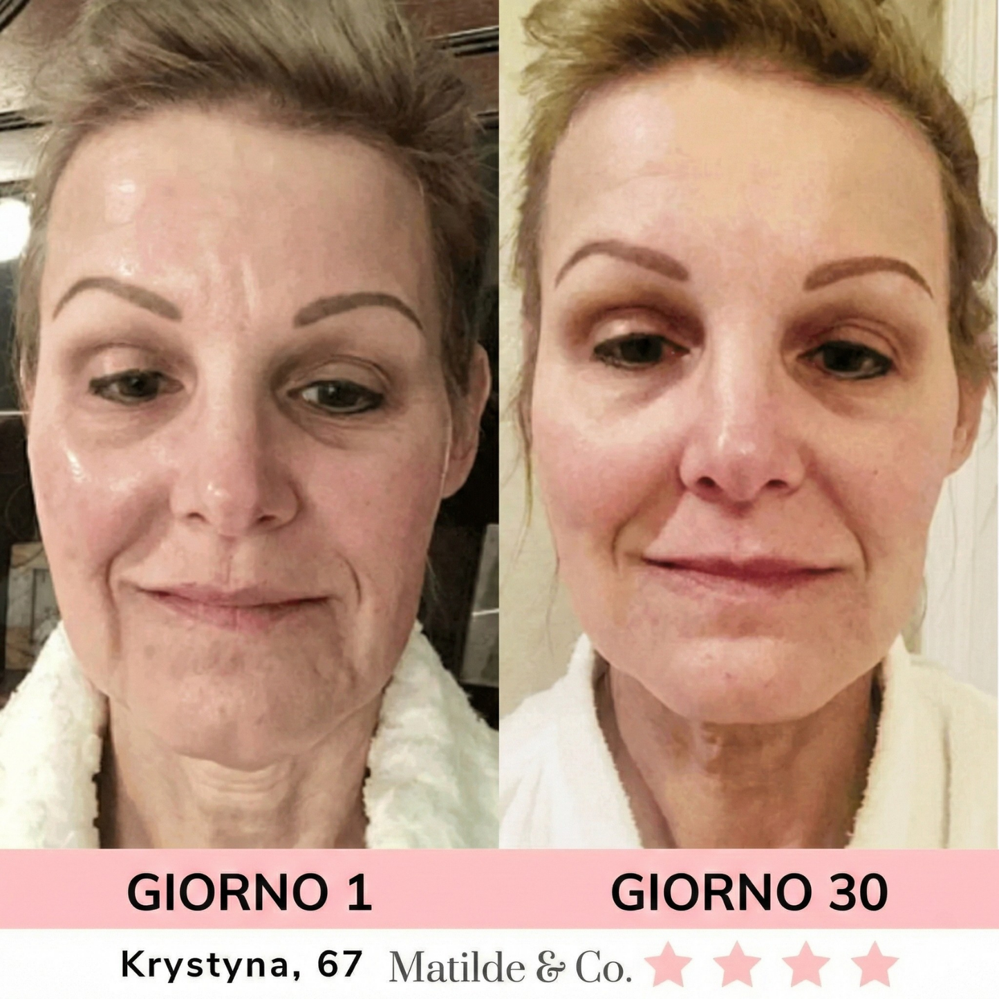 LUMINEA – Dispositivo Viso LED 7-in-1