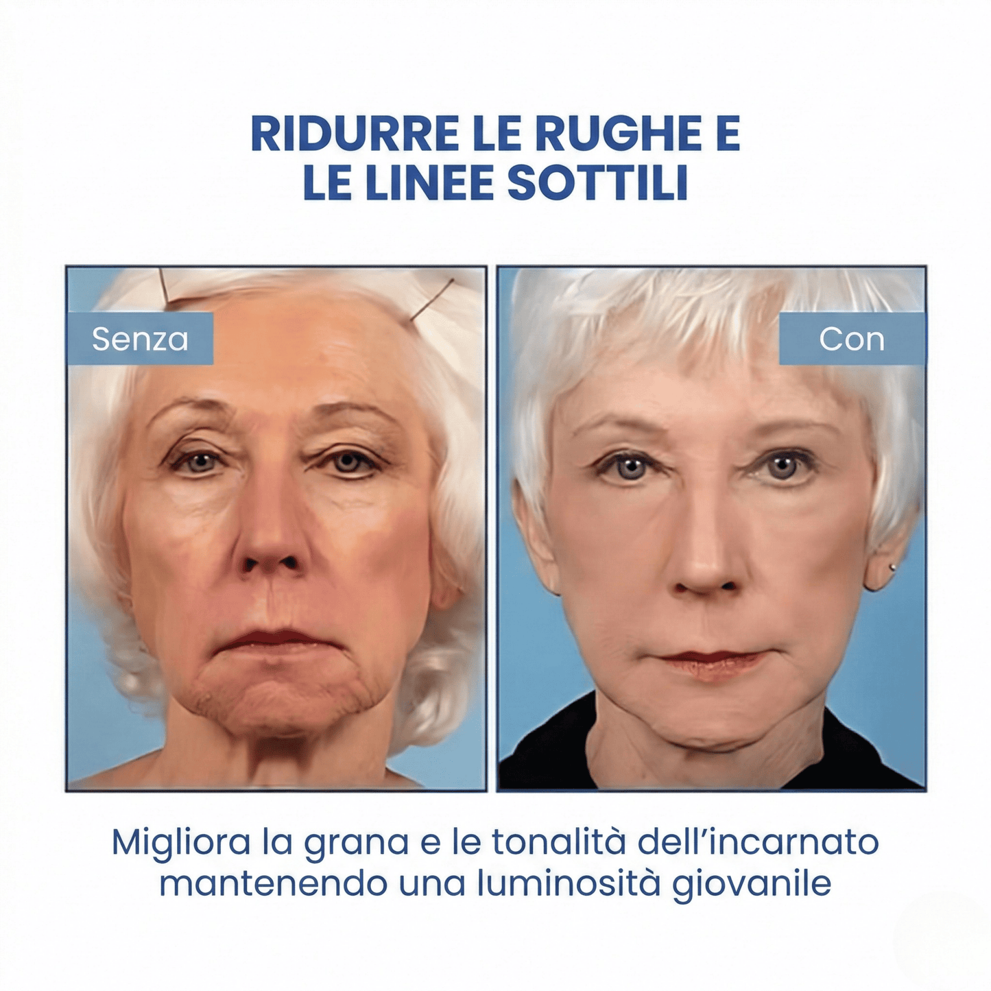 SkinLift™ | Siero Viso Botox