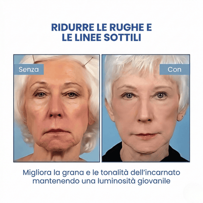 SkinLift™ | Siero Viso Botox