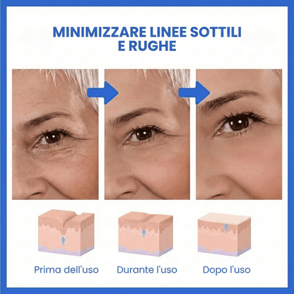 SkinLift™ | Siero Viso Botox