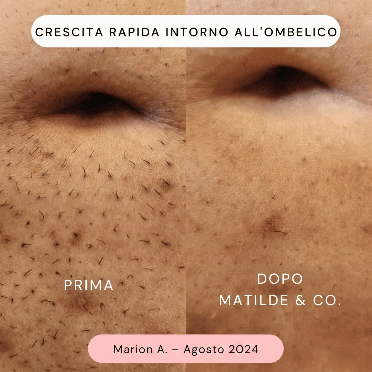 Matilde & Co • Rasoio elettrico per zone intime