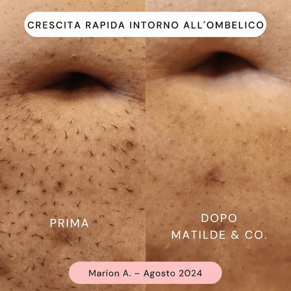 Matilde & Co • Rasoio elettrico per zone intime