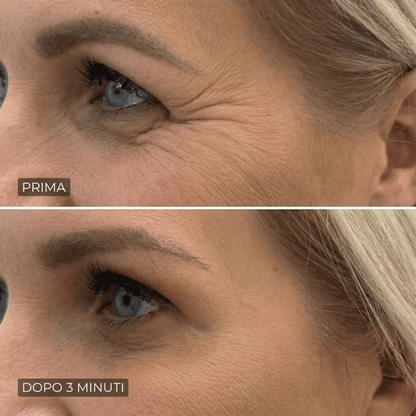 Eline™ - Levigante Rughe