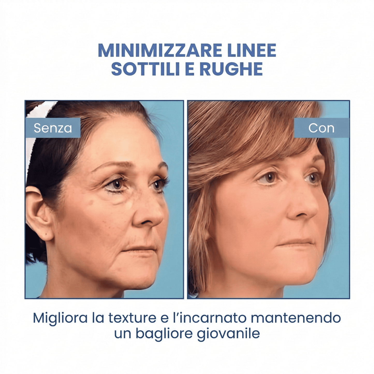SkinLift™ | Siero Viso Botox
