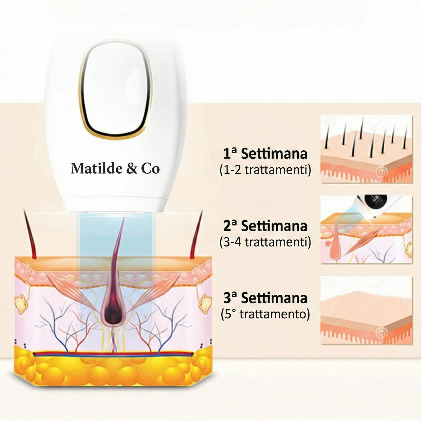 Matilde & Co. Epilatore a luce pulsata