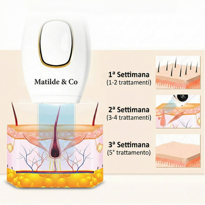 Matilde & Co. Epilatore a luce pulsata