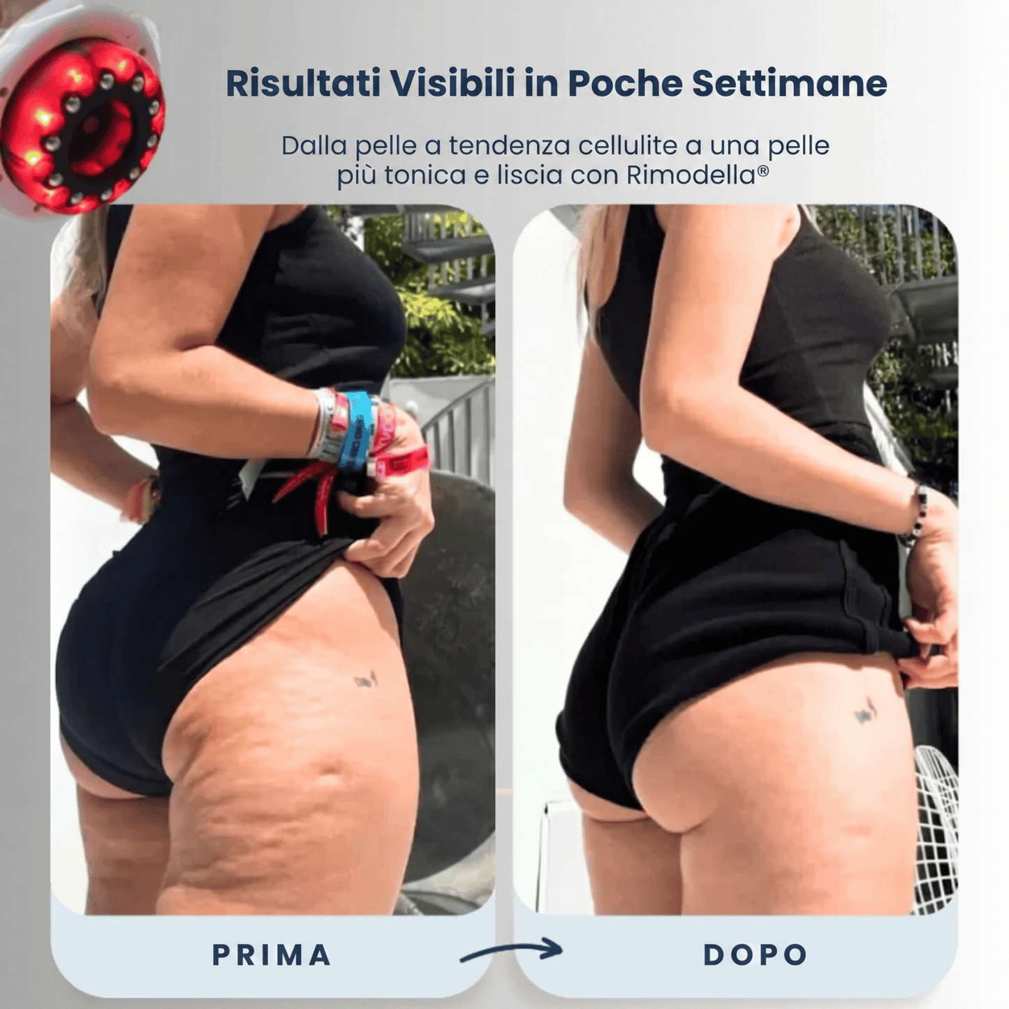 Rimodella