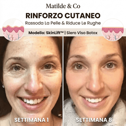 SkinLift™ | Siero Viso Botox