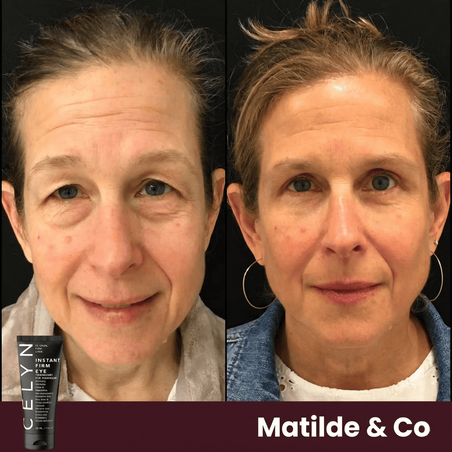 Crema Occhiaie e Rughe Istantanea