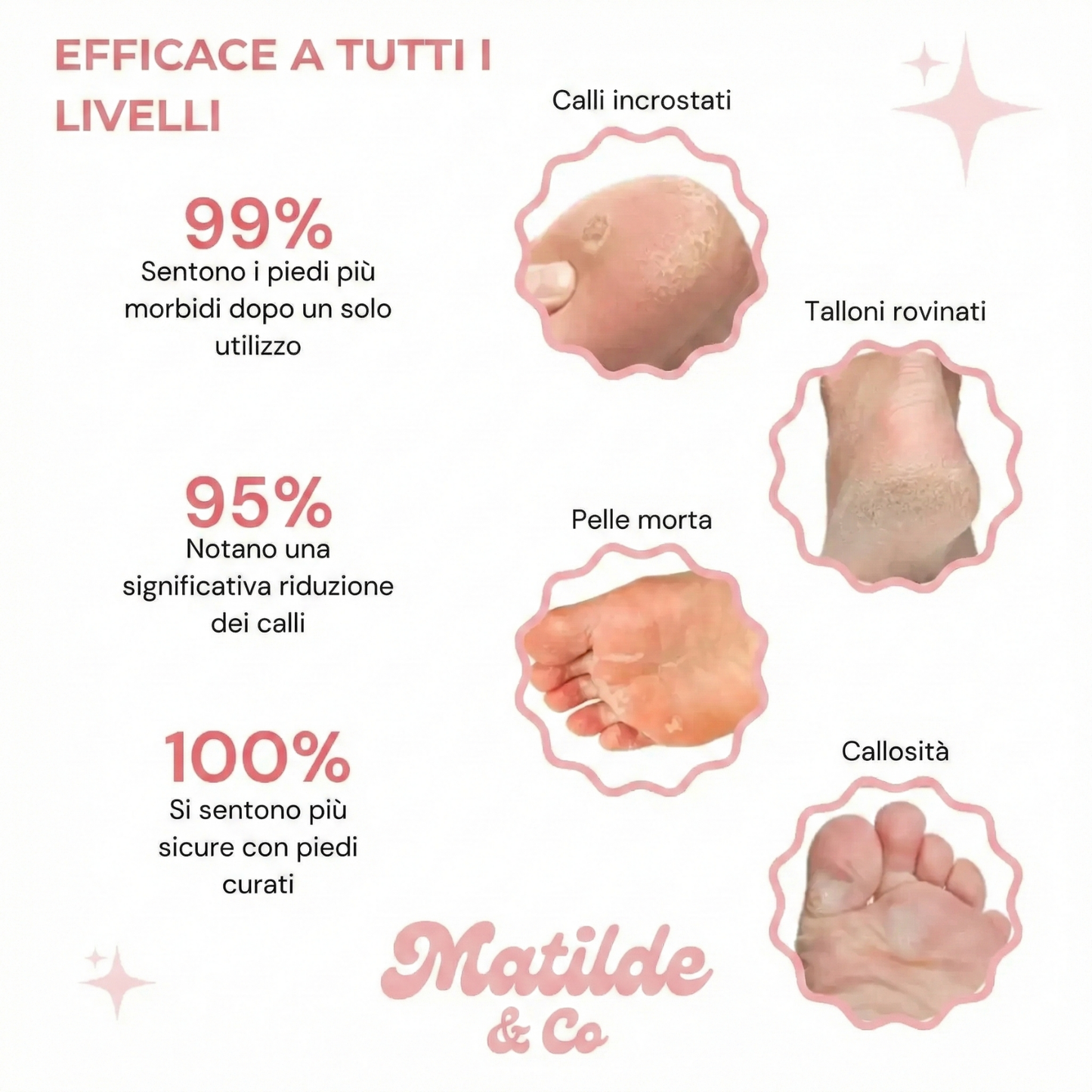 PIUMA - Levigatore Piedi Matilde & Co