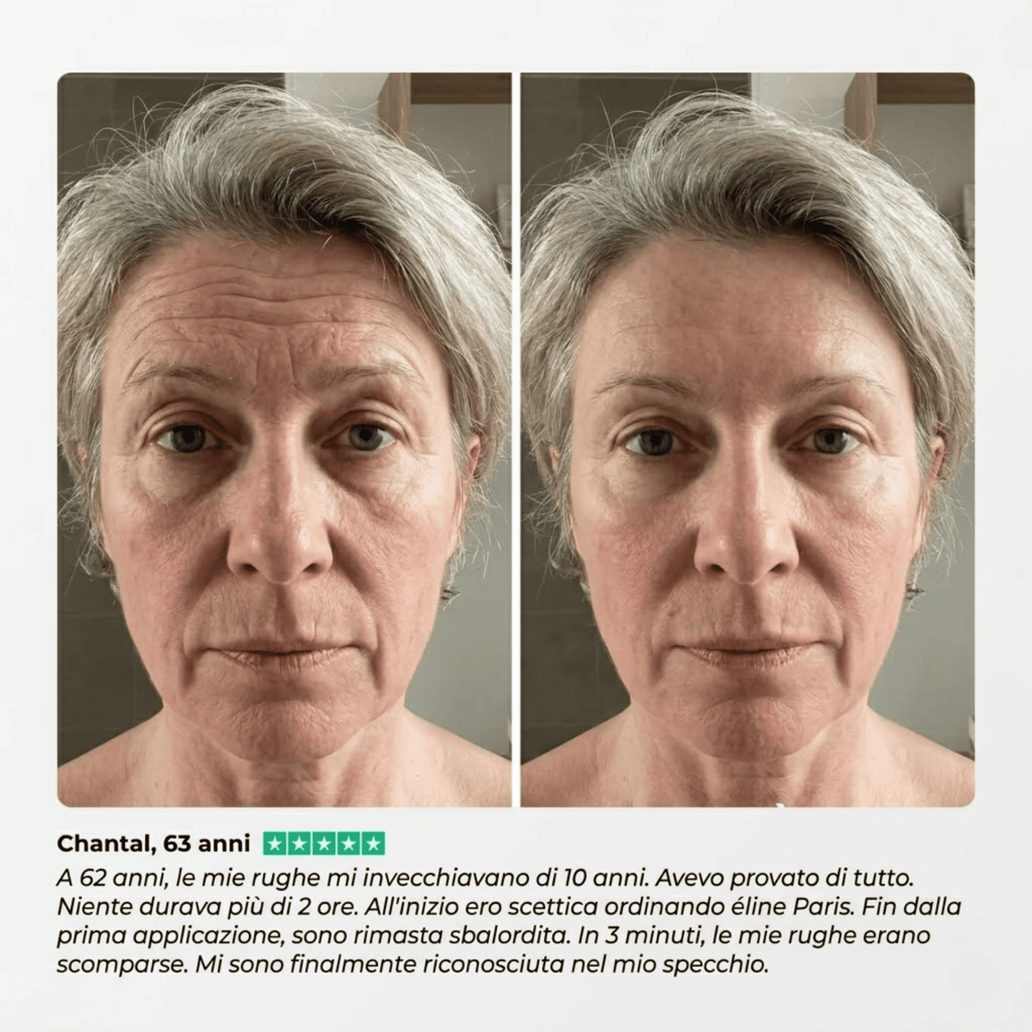 Eline™ - Levigante Rughe