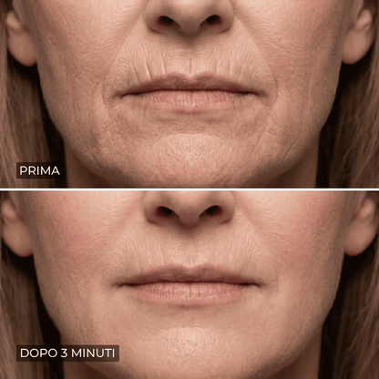 Eline™ - Levigante Rughe