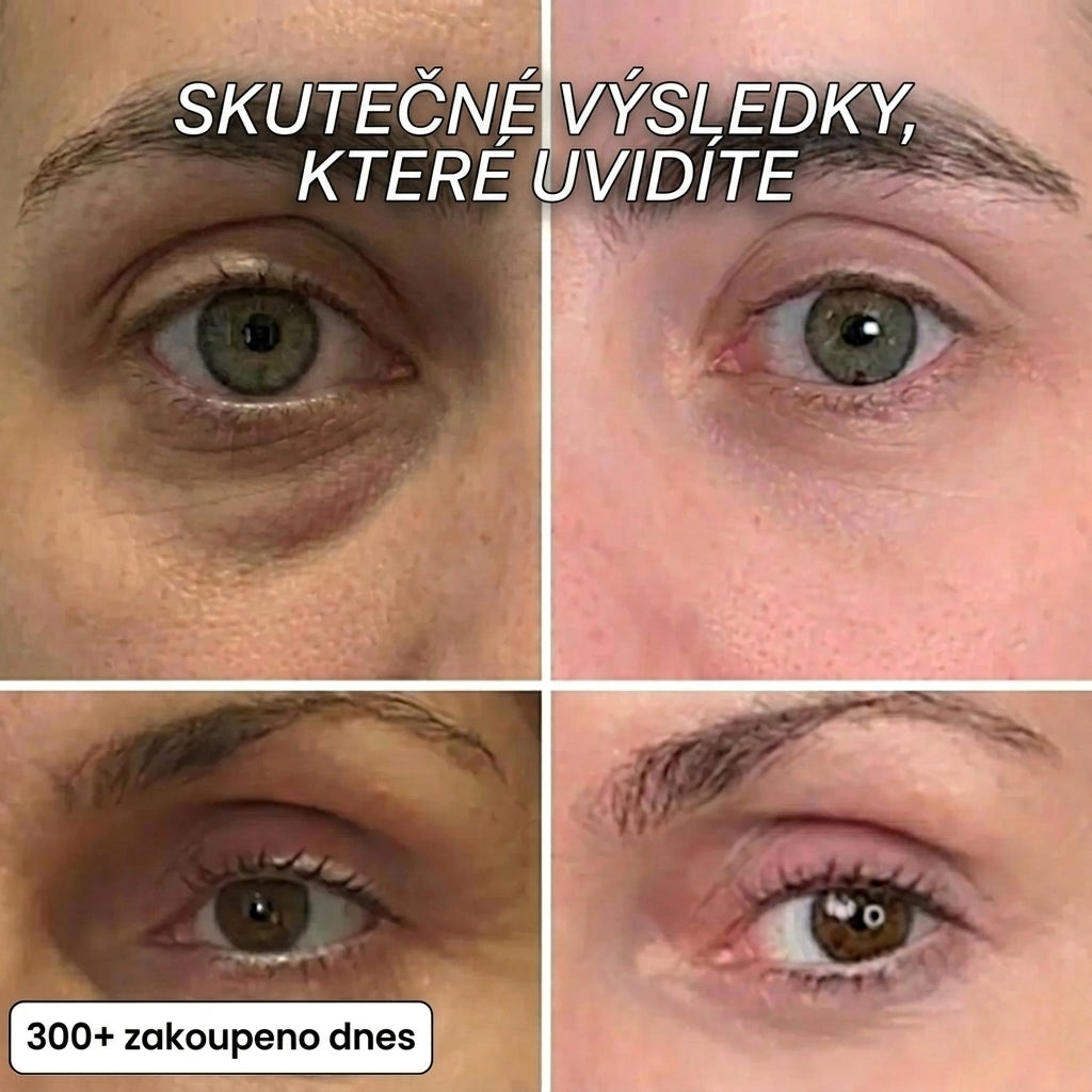 Vyplňující tyčinka s bio-kolagenem a PDRN