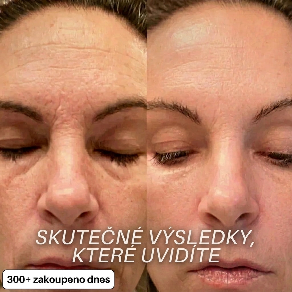 Vyplňující tyčinka s bio-kolagenem a PDRN